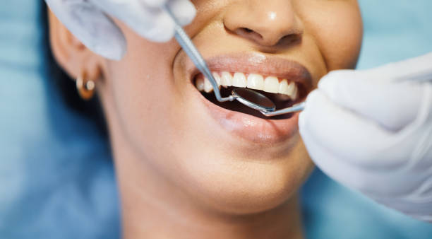 Best Emergency Wisdom Teeth Removal in Frostproof, FL